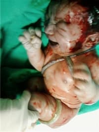 Uzm. Dr. Burhan Çetin